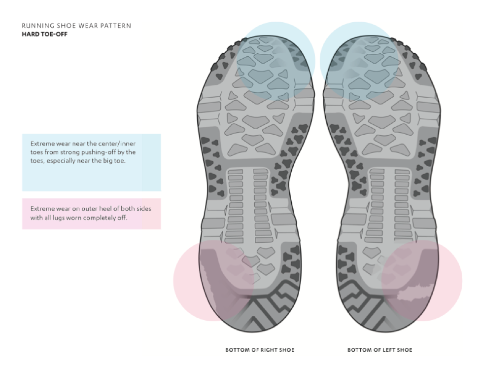 pronation gait pattern on running shoes