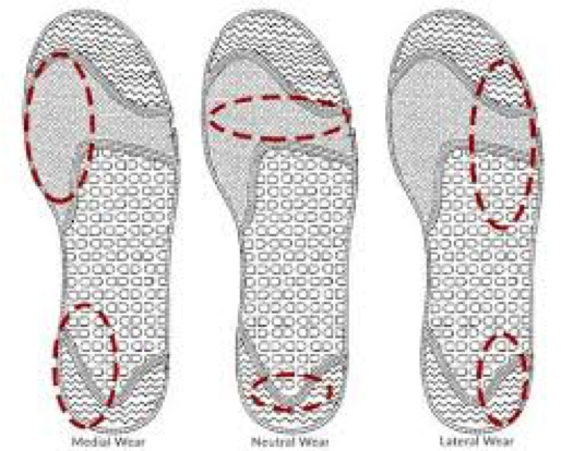 shoe wear patterns on running shoes